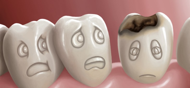 Ten Myths and a Fact about Cavities
