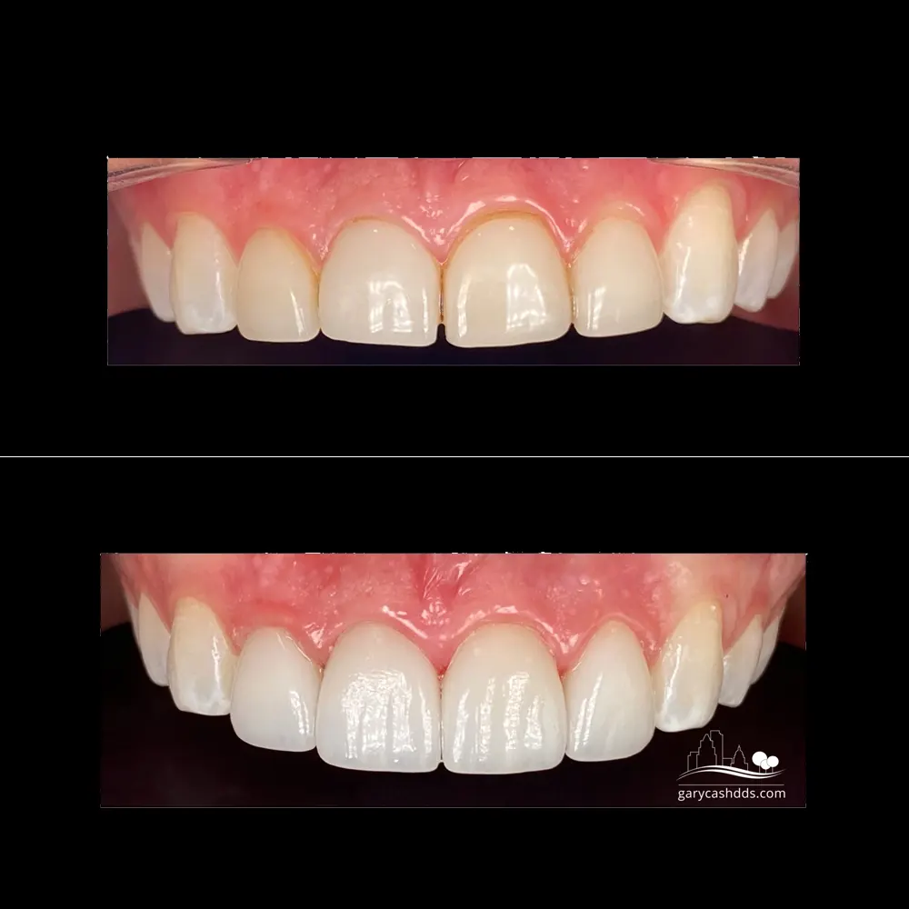 Are you ready for smile transformation?
